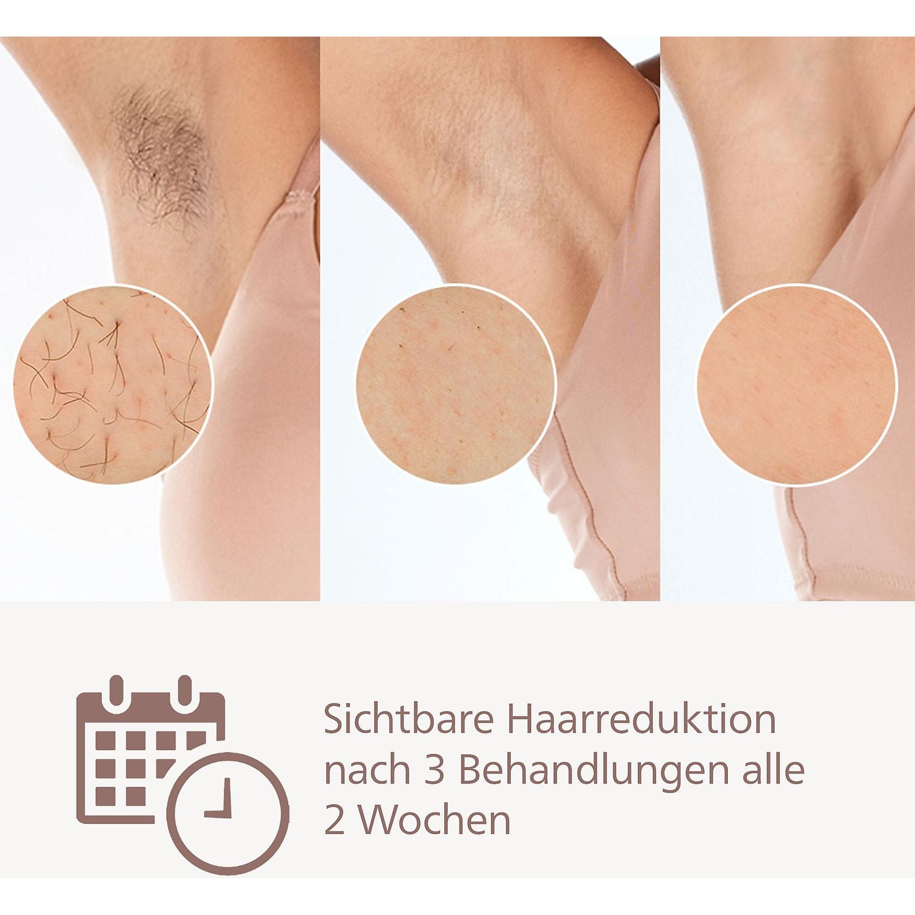 PHILIPS Lumea IPL S9000 BRI957/00 seidig glatte Haut Haarentfernung Rosa PHILIPS